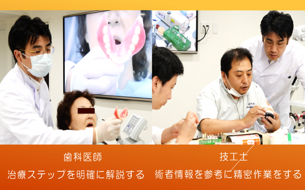 総入れ歯治療における、歯科医師と技工士の連携