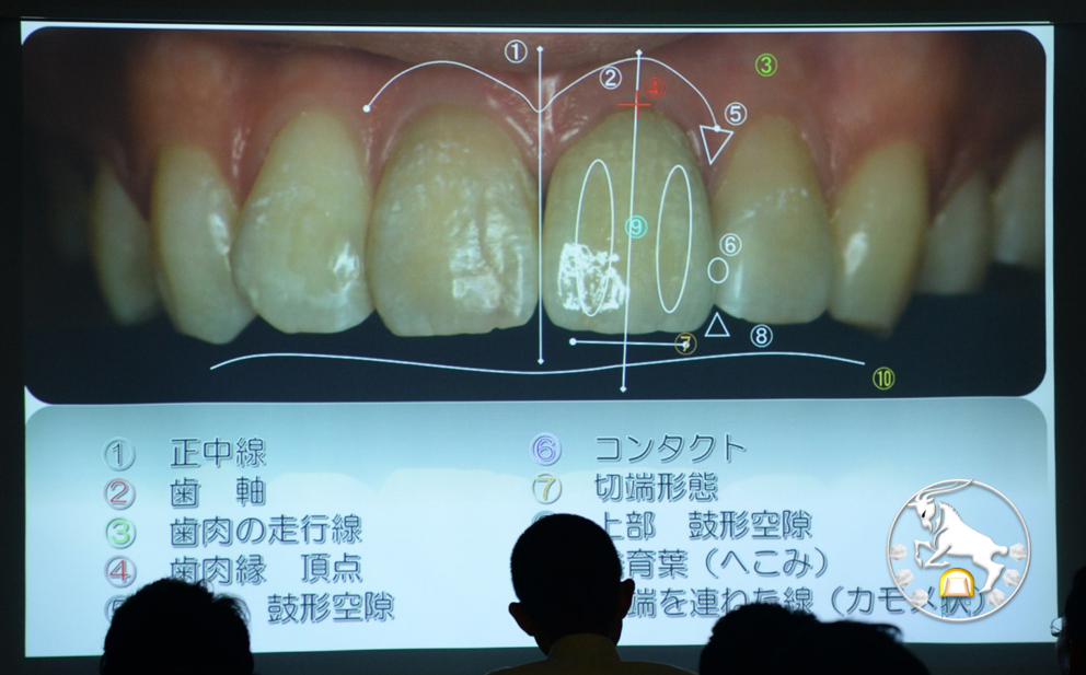 ハーモニックオクルージョンセミナー