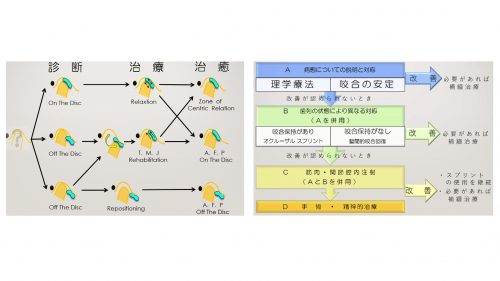 顎関節症の発症原因になる咬合について６