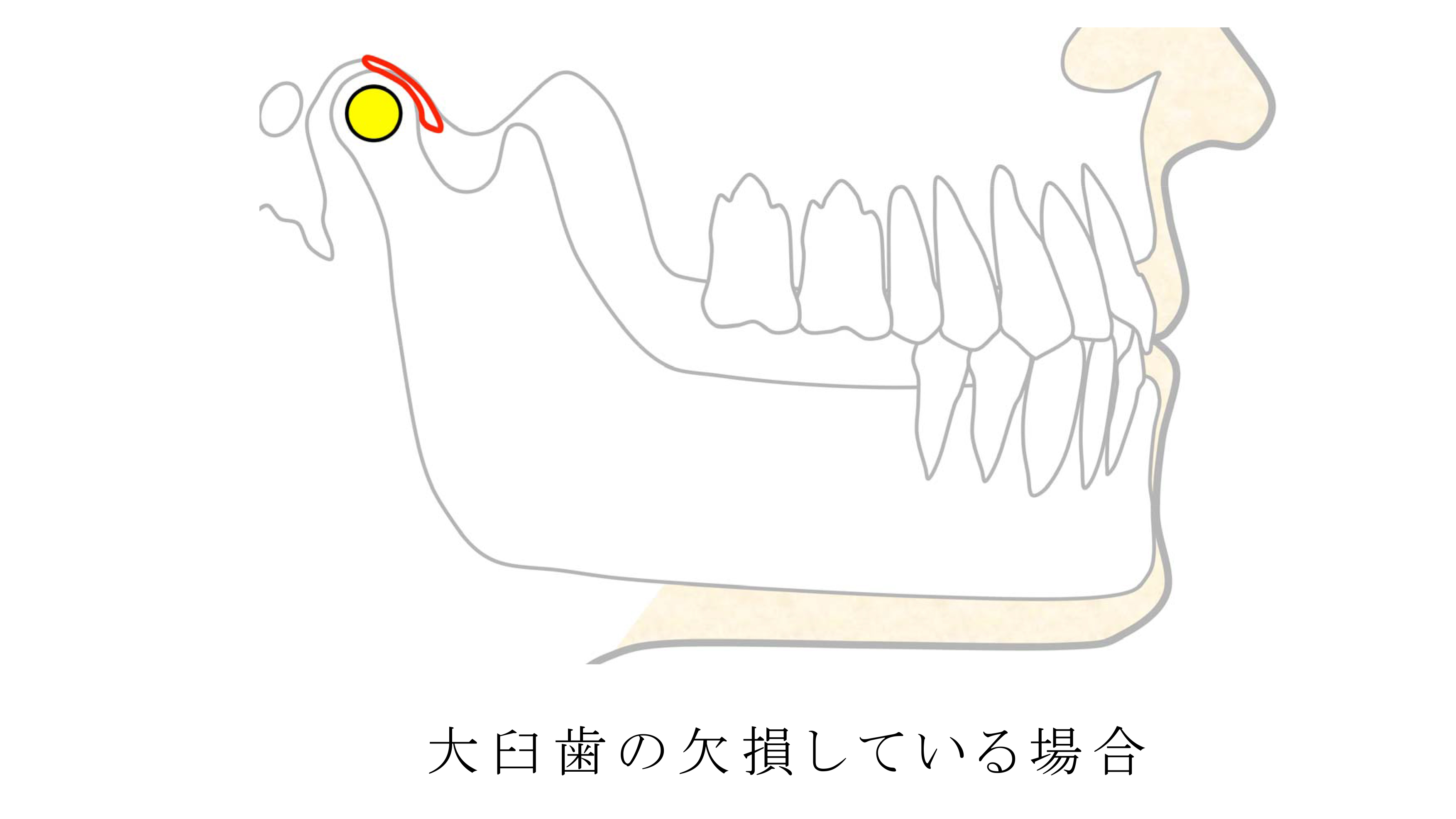 咬み合わせに違和感がある方へ】奥歯の重要性について | 千葉県松戸市